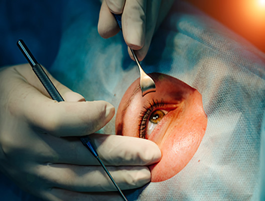 Precious Eye Hospital